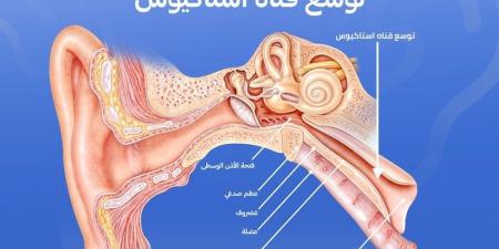 كيف نمنع تطور التهاب الأذن الوسطى أثناء نزلات البرد؟ - اخبارك الان