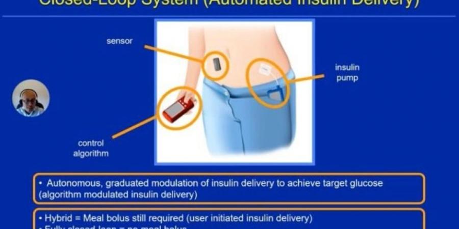 وداعًا للإبر.. الكشف عن جهاز البنكرياس الصناعي لقياس السكر وقت النوم بالخبر - اخبارك الان