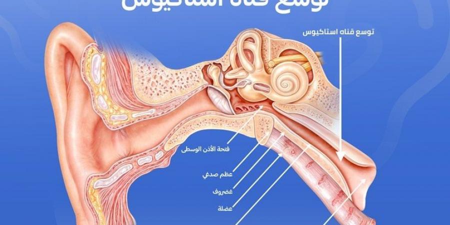 كيف نمنع تطور التهاب الأذن الوسطى أثناء نزلات البرد؟ - اخبارك الان