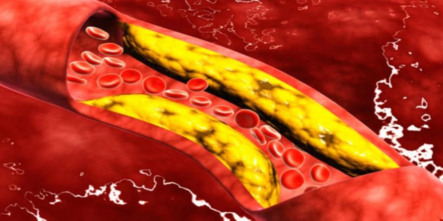 3 عادات صباحية تساعدك على التخلص من الكوليسترول - اخبارك الان