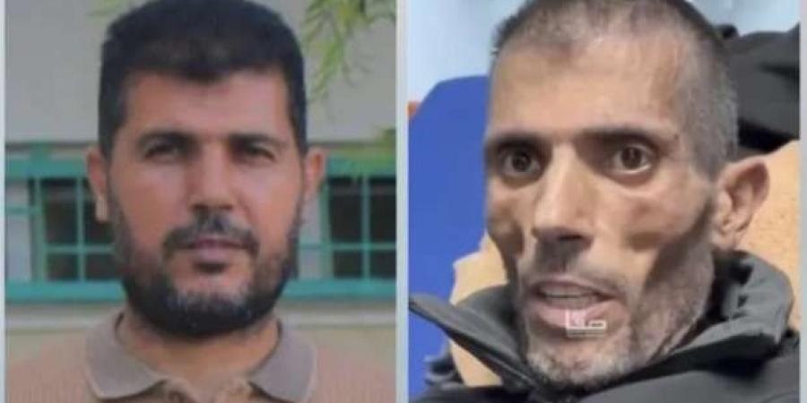 «بقى هيكل عظمي».. صور لفلسطيني قبل وبعد الإفراج عنه من سجون إسرائيل: تعذيب لا يوصف - اخبارك الان